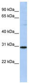 RAB26, Member RAS Oncogene Family antibody, TA334523, Origene, Western Blot image 