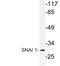 Snail Family Transcriptional Repressor 1 antibody, LS-C176686, Lifespan Biosciences, Western Blot image 