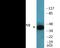 Mitogen-Activated Protein Kinase Kinase 1 antibody, EKC2457, Boster Biological Technology, Western Blot image 