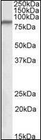 NADH:Ubiquinone Oxidoreductase Core Subunit S1 antibody, orb95805, Biorbyt, Western Blot image 