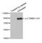 Catenin Beta 1 antibody, STJ22084, St John