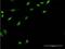 Ubiquitin Conjugating Enzyme E2 E3 antibody, H00010477-M05, Novus Biologicals, Immunofluorescence image 