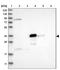DDHD Domain Containing 2 antibody, NBP1-82965, Novus Biologicals, Western Blot image 