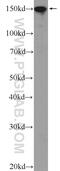 Uveal Autoantigen With Coiled-Coil Domains And Ankyrin Repeats antibody, 25654-1-AP, Proteintech Group, Western Blot image 