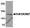 CASK Interacting Protein 2 antibody, 6663, ProSci, Western Blot image 