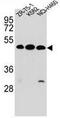 KRM2 antibody, AP52408PU-N, Origene, Western Blot image 