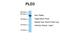Phospholipase D Family Member 3 antibody, NBP1-59921, Novus Biologicals, Western Blot image 
