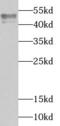 TIA1 Cytotoxic Granule Associated RNA Binding Protein antibody, FNab08685, FineTest, Western Blot image 