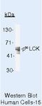 LCK Proto-Oncogene, Src Family Tyrosine Kinase antibody, MA5-12303, Invitrogen Antibodies, Western Blot image 