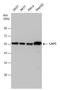 Leucine Aminopeptidase 3 antibody, GTX131074, GeneTex, Western Blot image 