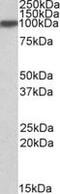 Aconitase 1 antibody, MBS421648, MyBioSource, Western Blot image 