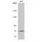 Matrix Metallopeptidase 2 antibody, LS-C384612, Lifespan Biosciences, Western Blot image 