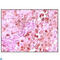 Protein S100-A6 antibody, LS-C812409, Lifespan Biosciences, Western Blot image 