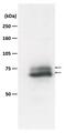 RAD18 E3 Ubiquitin Protein Ligase antibody, GTX00886, GeneTex, Western Blot image 