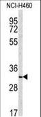 NAD(P)H Quinone Dehydrogenase 1 antibody, LS-C100530, Lifespan Biosciences, Western Blot image 