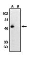 C-X3-C Motif Chemokine Receptor 1 antibody, orb108748, Biorbyt, Western Blot image 