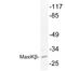 Potassium Calcium-Activated Channel Subfamily M Regulatory Beta Subunit 4 antibody, LS-B12559, Lifespan Biosciences, Western Blot image 