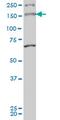 Myosin IIIA antibody, MA5-24580, Invitrogen Antibodies, Western Blot image 