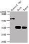 Cyclin Dependent Kinase 4 antibody, CSB-RA965615A0HU, Cusabio, Immunoprecipitation image 