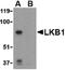 Serine/Threonine Kinase 11 antibody, LS-B592, Lifespan Biosciences, Western Blot image 