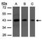 Serpin Family I Member 1 antibody, GTX106371, GeneTex, Western Blot image 