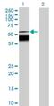 Succinyl-CoA:Glutarate-CoA Transferase antibody, H00079783-B01P, Novus Biologicals, Western Blot image 