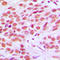 FOS Like 2, AP-1 Transcription Factor Subunit antibody, LS-C352207, Lifespan Biosciences, Immunohistochemistry paraffin image 