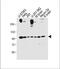 Fibroblast Growth Factor Receptor 1 antibody, M00098-2, Boster Biological Technology, Western Blot image 