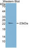 TIMP Metallopeptidase Inhibitor 1 antibody, LS-C314190, Lifespan Biosciences, Western Blot image 