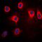 Mitogen-Activated Protein Kinase Kinase Kinase 8 antibody, orb216065, Biorbyt, Immunofluorescence image 