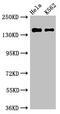 Early Endosome Antigen 1 antibody, CSB-PA007405LA01HU, Cusabio, Western Blot image 