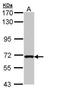 Calcium and DAG-regulated guanine nucleotide exchange factor I antibody, GTX108616, GeneTex, Western Blot image 