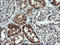 Mitogen-Activated Protein Kinase Kinase 1 antibody, LS-C338034, Lifespan Biosciences, Immunohistochemistry paraffin image 