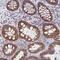 Collagen Triple Helix Repeat Containing 1 antibody, NBP2-31797, Novus Biologicals, Immunohistochemistry frozen image 