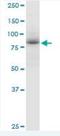 Adenosine Deaminase RNA Specific B1 antibody, H00000104-B01P, Novus Biologicals, Western Blot image 