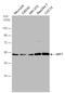 Eukaryotic Translation Termination Factor 1 antibody, GTX108271, GeneTex, Western Blot image 