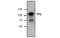 Telomerase Reverse Transcriptase antibody, MBS835583, MyBioSource, Western Blot image 