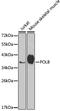 DNA Polymerase Beta antibody, GTX55594, GeneTex, Western Blot image 