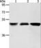 Acyl-CoA Thioesterase 9 antibody, LS-C404440, Lifespan Biosciences, Western Blot image 