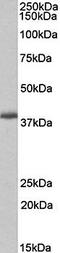 PDZ And LIM Domain 2 antibody, orb167691, Biorbyt, Western Blot image 