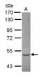 Coiled-Coil Domain Containing 17 antibody, GTX120083, GeneTex, Western Blot image 