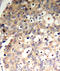 Protein Tyrosine Phosphatase Non-Receptor Type 6 antibody, LS-C336069, Lifespan Biosciences, Immunohistochemistry paraffin image 