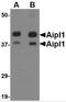 Aryl Hydrocarbon Receptor Interacting Protein Like 1 antibody, 4865, ProSci, Western Blot image 