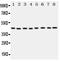 Phosphoglycerate Kinase 1 antibody, PA2045, Boster Biological Technology, Western Blot image 