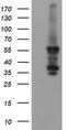 Chaperonin Containing TCP1 Subunit 8 Like 2 antibody, MA5-26109, Invitrogen Antibodies, Western Blot image 