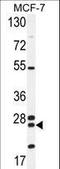 Nudix Hydrolase 8 antibody, LS-C203684, Lifespan Biosciences, Western Blot image 