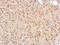 Inhibitor Of Nuclear Factor Kappa B Kinase Subunit Epsilon antibody, PA5-29294, Invitrogen Antibodies, Immunohistochemistry paraffin image 