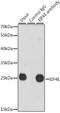 Eukaryotic Translation Initiation Factor 4E antibody, GTX32580, GeneTex, Immunoprecipitation image 