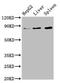 NOP2/Sun RNA Methyltransferase 2 antibody, CSB-PA626626LA01HU, Cusabio, Western Blot image 
