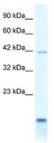 Purinergic Receptor P2X 6 antibody, TA338554, Origene, Western Blot image 